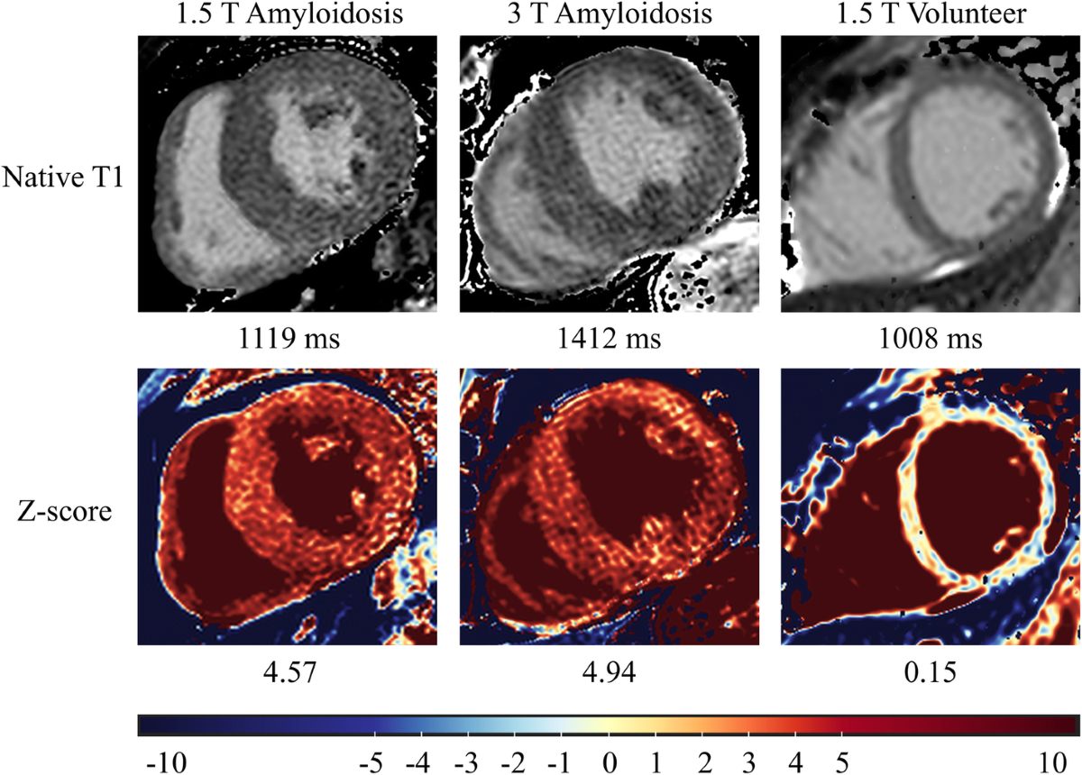 zScore decentralized credit scoring system